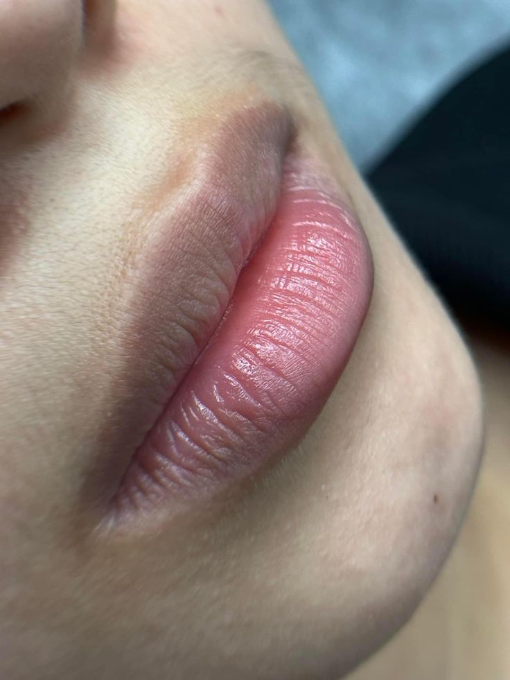 UPER LIP